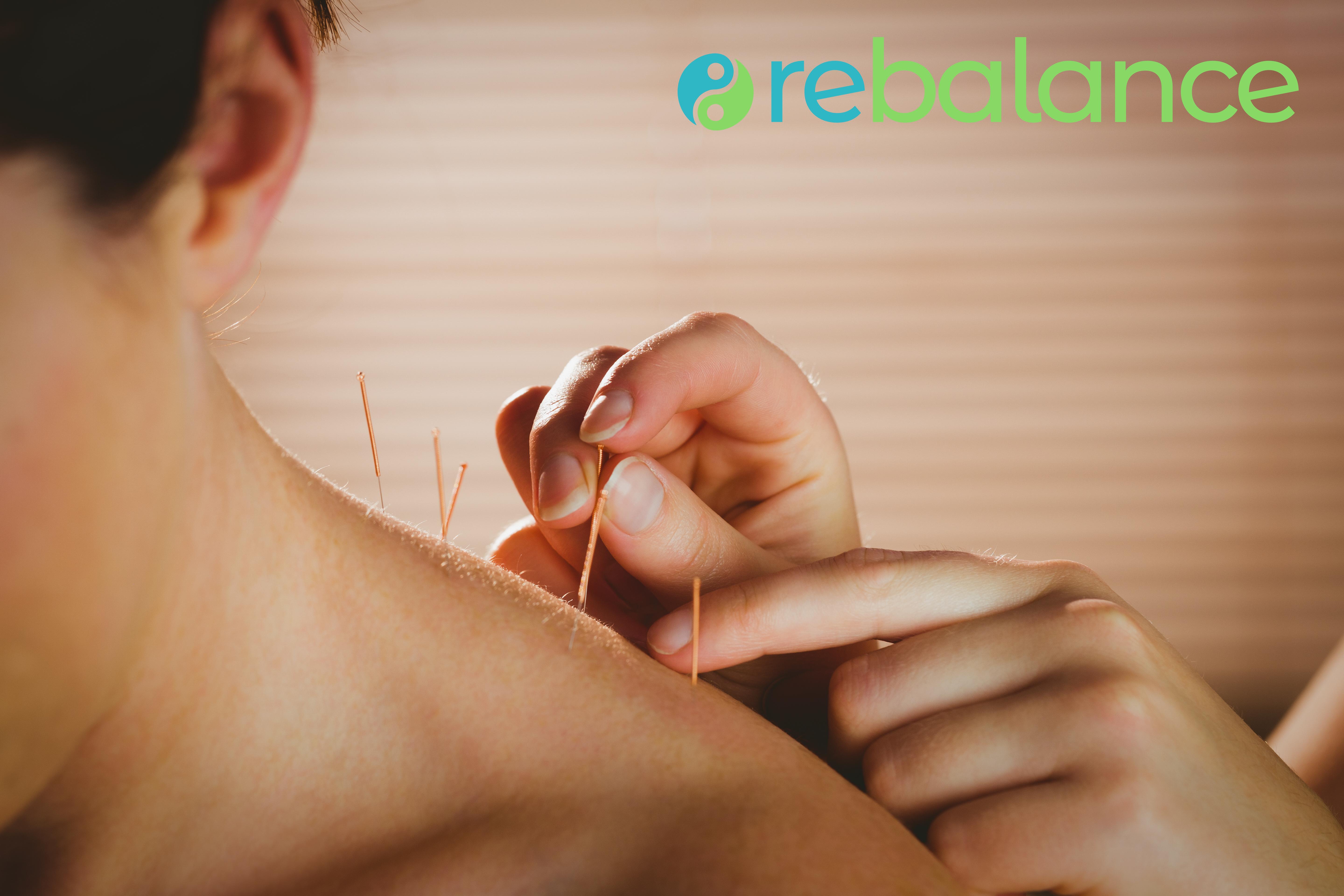 Rebalance Acupuncture Edmonton