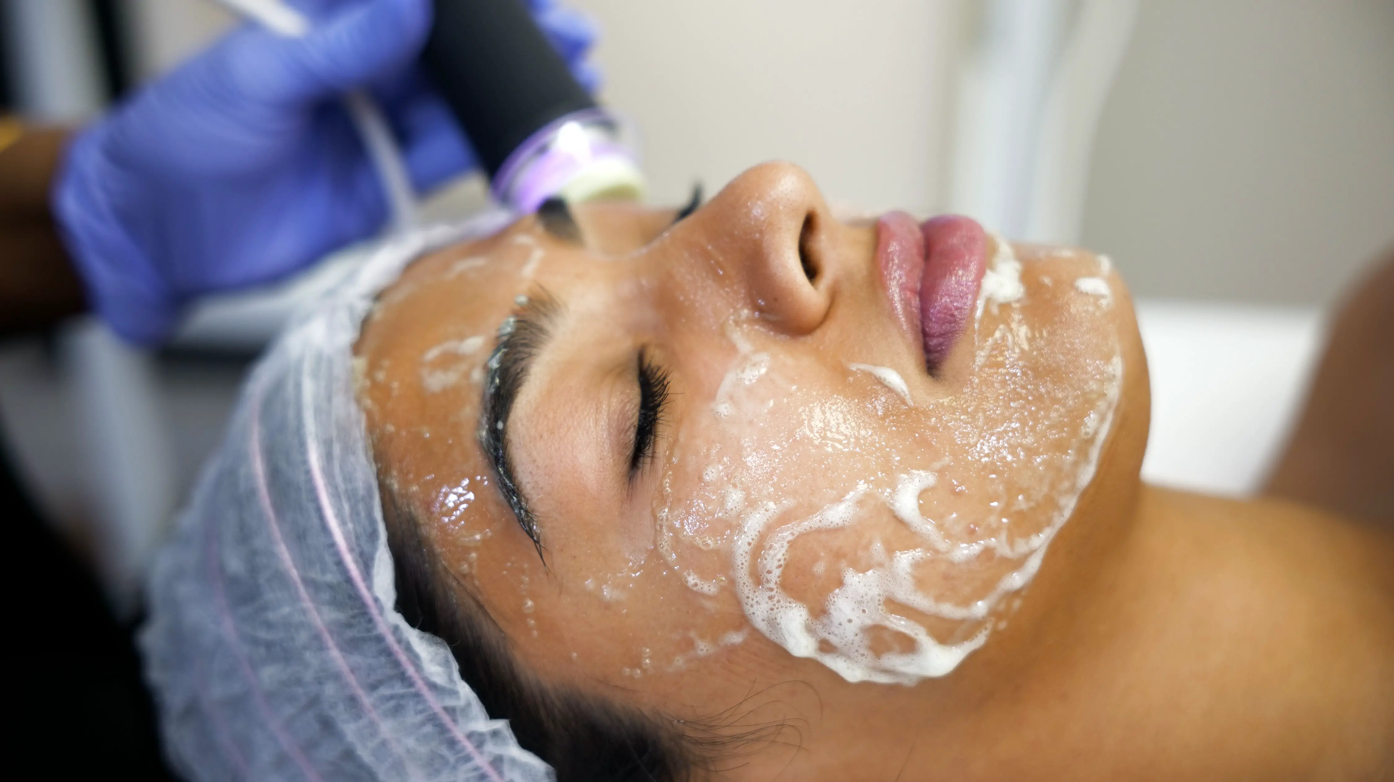 Tropicalaser | Laser Hair Removal Facials & Skin Treatments MedSpa Edmonton